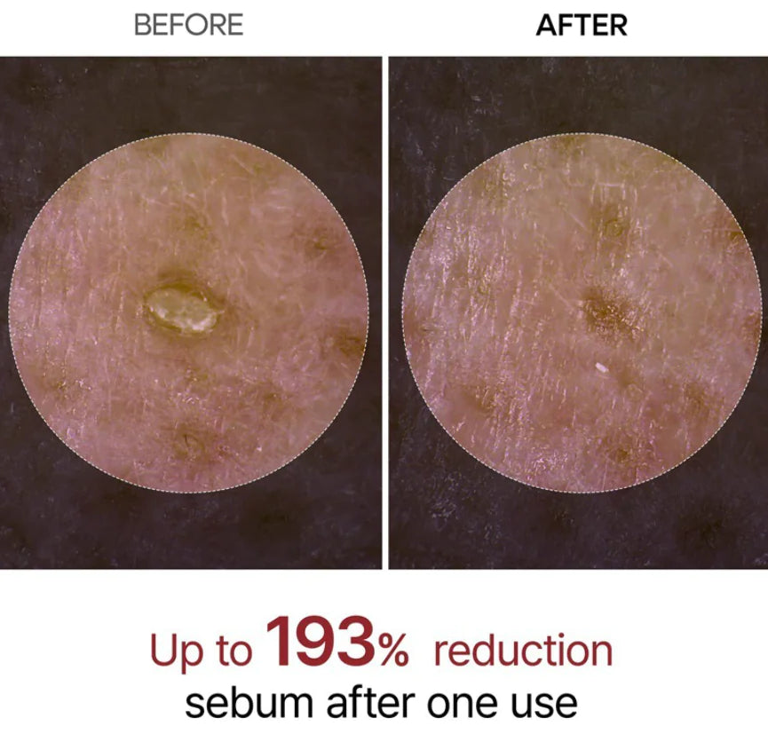 Dr. Melaxin Rice Peel Shot